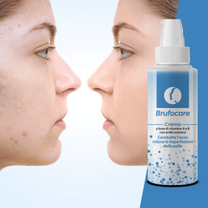 donna prima e dopo Brufocare