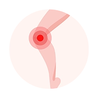 Dolore alle ginocchia