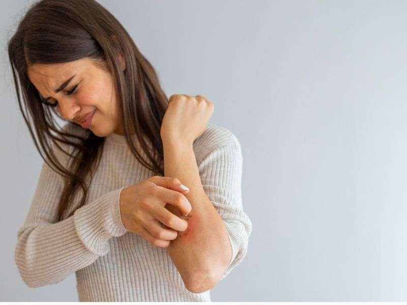 Cause della psoriasi, donna colpita alle braccia