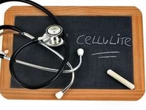 sconfiggere la cellulite