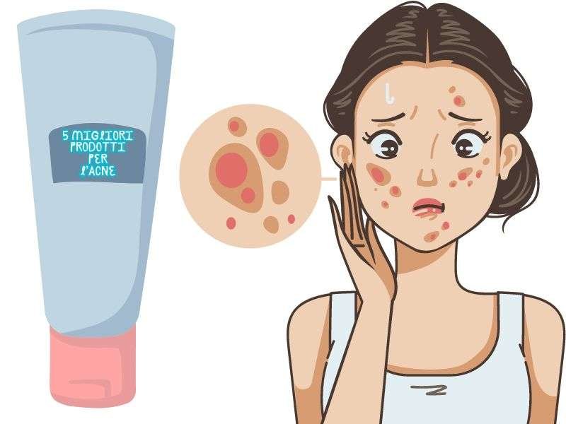 PRODOTTI PER L'ACNE