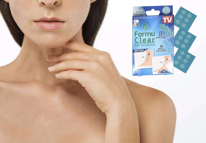 ragazza che ha utilizzato il cerotto anti verruche skin tag patch